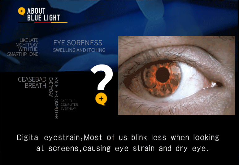 How could KOI eyewear helps you? – KOI ESPORTS
